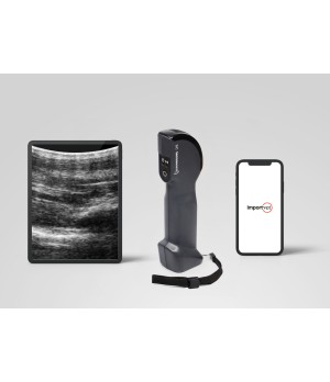 Ultrasound scanner for early detection of pregnancy and measurement